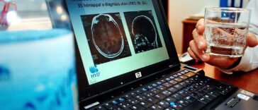 Mi vallott kudarcot, az új rákterápia vagy a szabályozók?