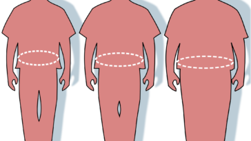 Obezitológia. Nem ismerős? Elhízástudomány! Érdekes téma!