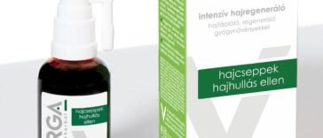 Női kopaszodás: Okai, tünetei és kezelési lehetőségek