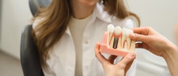 Miért az implantátum a legjobb választás a fogak pótlására? A fogorvos válaszol