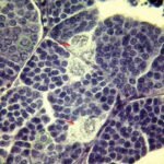 Interstitium