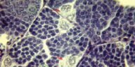 Interstitium
