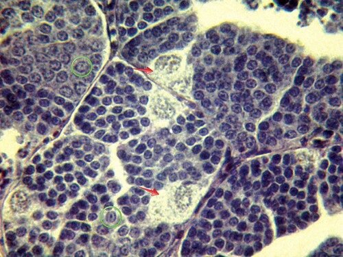 Interstitium