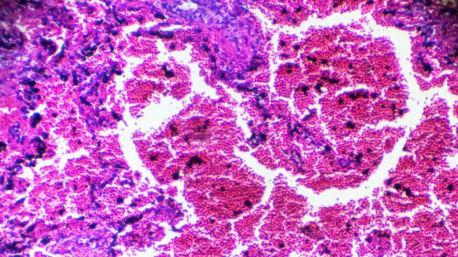 interstitium