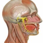 Arcidegzsába - Trigeminus Neuralgia