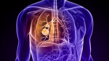 Lélegezzen könnyebben! - mit tegyen, ha COPD betegsége van?