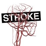 Korszakalkotó vizsgálati eredmények: jobb gyógyulási esélyek stroke illetve vénás thromboembolia után 14 Korszakalkotó vizsgálati eredmények: jobb gyógyulási esélyek stroke illetve vénás thromboembolia után