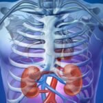 Egészséges a veséje? 14 Egészséges a veséje?