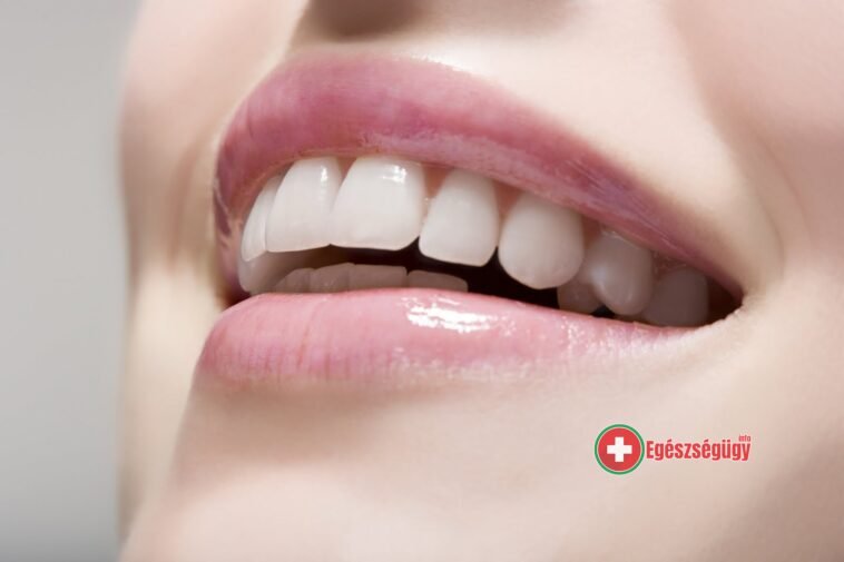 A tiszta, ápolt fogak nem szuvasodnak