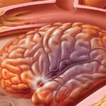 Tudatosan a stroke ellen