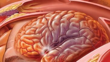 Tudatosan a stroke ellen