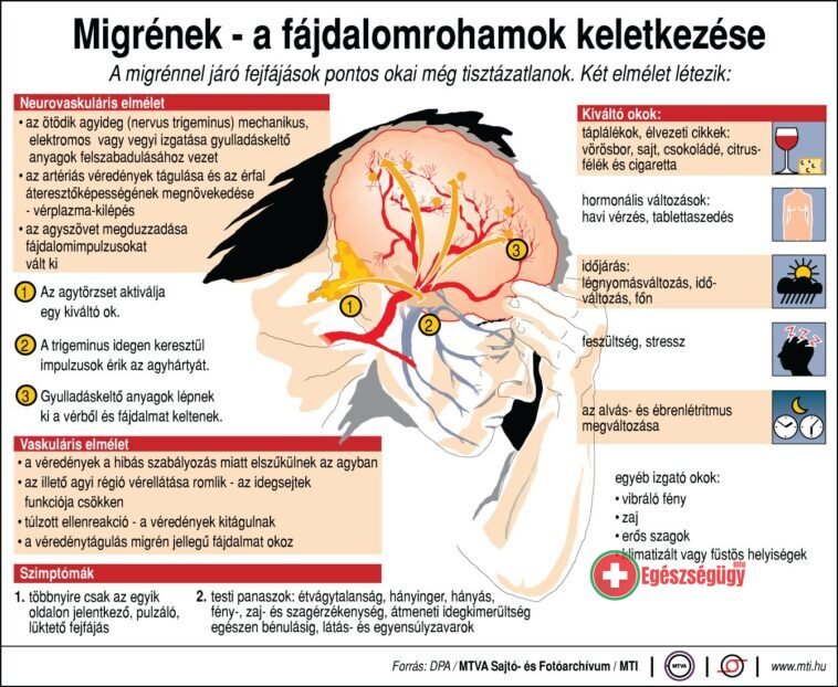 Migrén - a fájdalomroham keletkezése