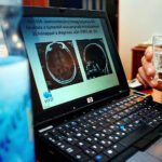 Mi vallott kudarcot, az új rákterápia vagy a szabályozók?