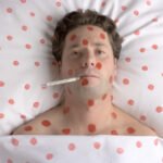 Ausztriában idén már 85 kanyarós esetet regisztráltak