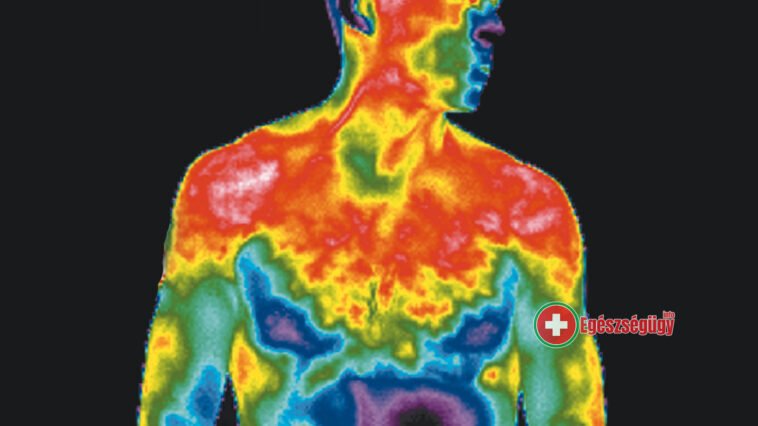 Gyulladáscsökkentéssel enyhíthetők a stroke hatásai magyar kutatók szerint