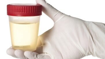 Down Egyesület közleménye