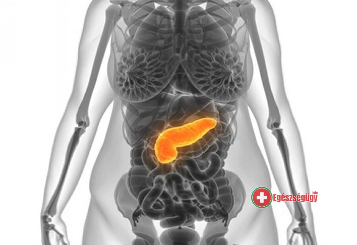 Mesterséges hasnyálmirigy beültetéssel bíró cukorbeteg kismama szült természetesen