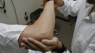 Intenzív fizikoterápiával visszahozhatók a szélütés után a felső végtag funkciói