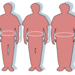 Obezitológia. Nem ismerős? Elhízástudomány! Érdekes téma! 15 Obezitológia. Nem ismerős? Elhízástudomány! Érdekes téma!