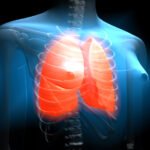 Mi is az az EGFR mutáció?