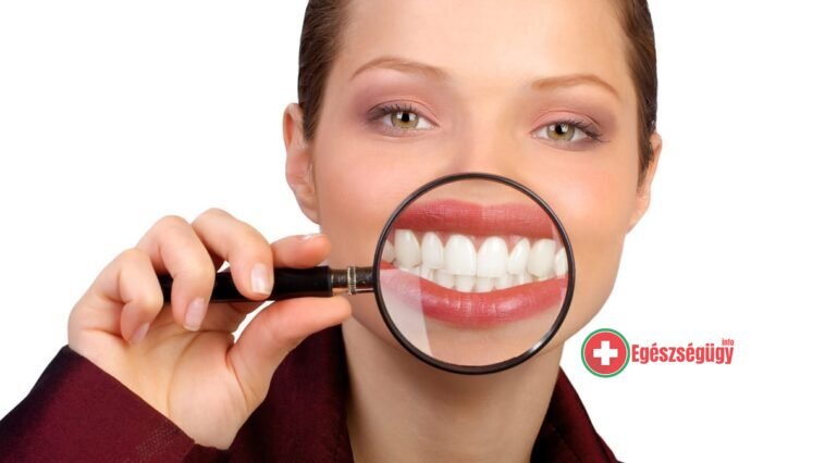 Várandósság alatti fogromlás? Mitől? És mitől nem?