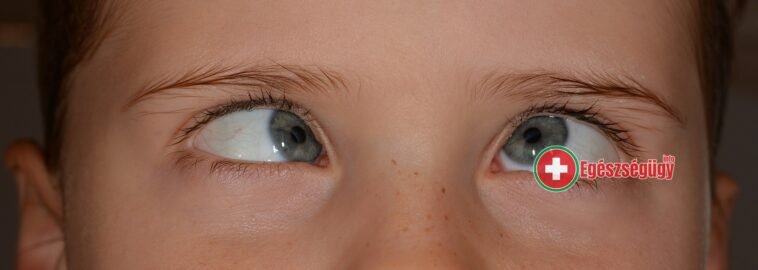 8 tápanyag ami a javítja a látásodat, a szem egészségét