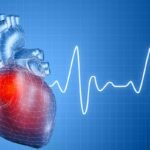 Szívinfarktus helyett