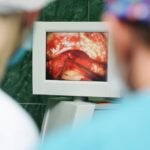 Májműtét 50 km távolságból – most még állatokon