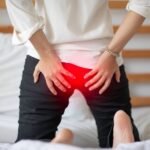 Mi a legjobb aranyér ellen?