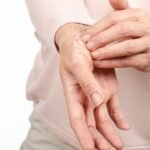 Bőrbetegség vagy sem? A pikkelysömör természete