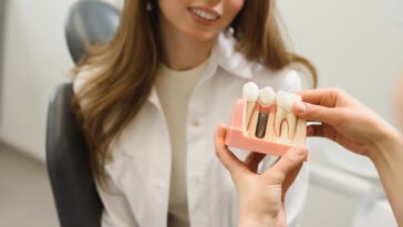 Miért az implantátum a legjobb választás a fogak pótlására? A fogorvos válaszol