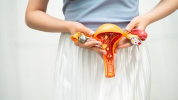 Hogyan befolyásolhatja a mindennapokat egy petefészek ciszta?