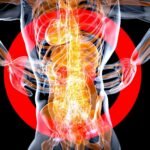 fibromyalgia szindróma