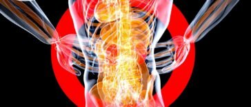 fibromyalgia szindróma