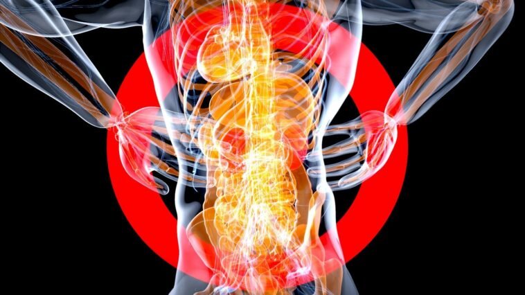 fibromyalgia szindróma