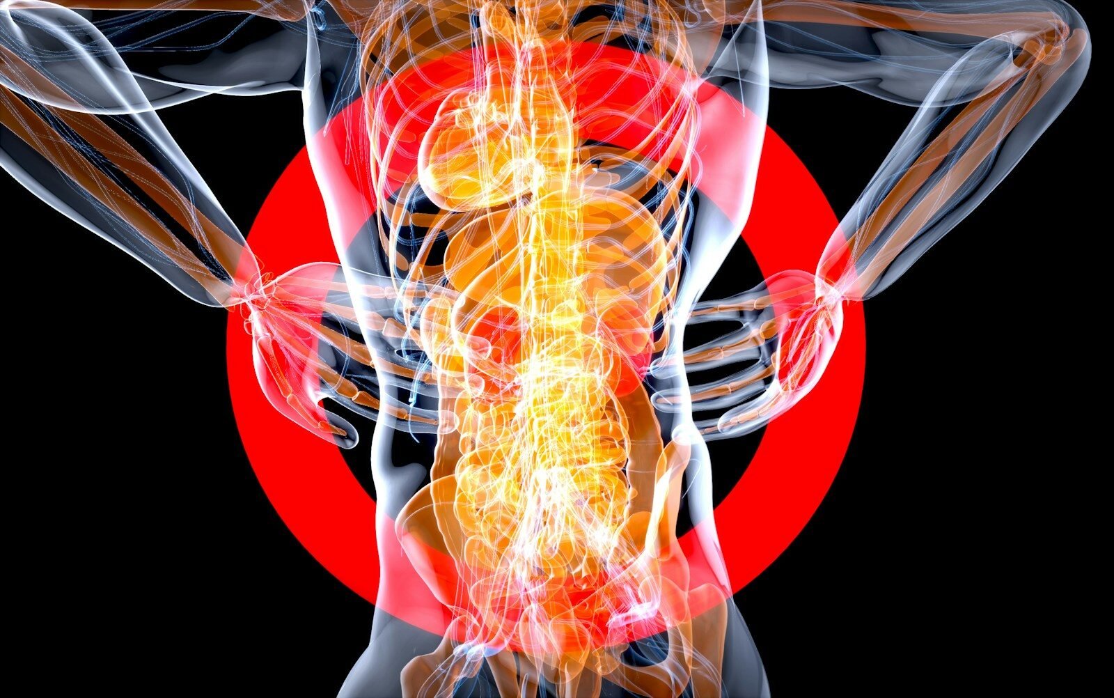 fibromyalgia szindróma